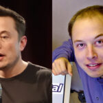 Story of Elon Musk's Hair Transplant - Things You Should Know. Bald Elon Musk Head before & after hair transplantation restoration