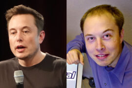 Story of Elon Musk's Hair Transplant - Things You Should Know. Bald Elon Musk Head before & after hair transplantation restoration